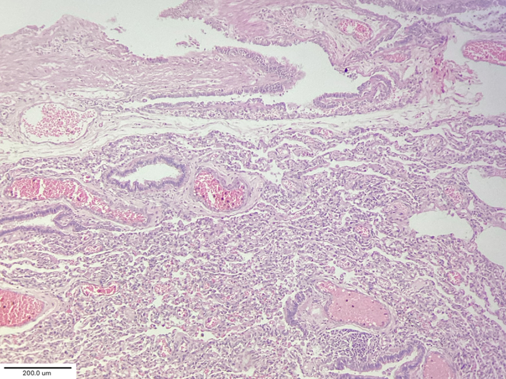 Fig 6 collapse